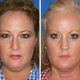 Illustration for article titled Guess which of these identical twins is the smoker